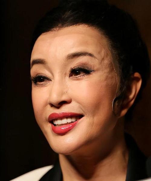 整形老了明星,整形明星的衰老之路