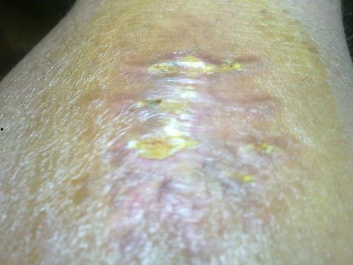 吃洋瓜伤口痒,揭秘洋瓜食用后的奇妙体验